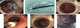 Official journal of the American College of Gastroenterology