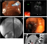 Official journal of the American College of Gastroenterology