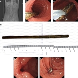 Official journal of the American College of Gastroenterology