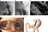 Official journal of the American College of Gastroenterology