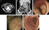 Official journal of the American College of Gastroenterology