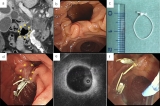 Official journal of the American College of Gastroenterology