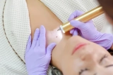 Smooth Skin Ahead: The Latest Innovations in Mole Removal