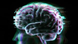 Brain scans reveal a possible cause of long COVID fatigue and brain fog
