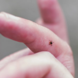 Tick Bites – How to Prevent, Identify, and Manage Them Safely