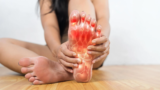 TikTok’s gout advice is everywhere and doctors say it’s often wrong