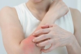 Understanding Sensitive Skin: Triggers and Treatments
