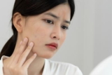 How to Manage Dry Skin During Seasonal Change