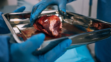 Nearly half of kidney transplant patients never even get started