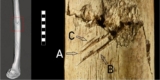 What a 17,000-Year-Old Skeleton Tells Us About Ice Age Conflict