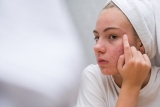Skin Purging vs. Breakout: The Difference in Teens