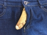 How Long Does it Take for Peeled Skin to Heal on Penis