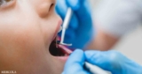 The Need to End Mercury Fillings for Children Now