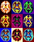 Food, Movement, and Multiple Sclerosis: Where the Gluten-Free Diet Fits and What It Means for Real Life