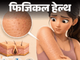Chicken Skin Reason; Keratosis Pilaris Symptoms