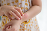 Pediatric Dermatology Myths | Clarus Dermatology