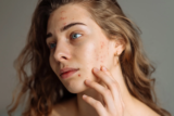 Skin & Stress: The Mental Health Connection