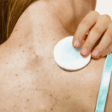 Do Supplements Help with Acne? What Science Really Says
