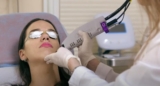 VBeam Laser for Broken Capillaries