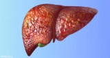 The Link Between Vitamin D Deficiency and Fatty Liver
