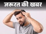 Winter Dandruff Problem; Home Remedy Treatment | Hair Scalp | जरूरत की खबर- सर्दियों में बढ़ती डैंड्रफ की समस्या: ठंड में न करें ये 10 गलतियां, डर्मेटोलॉजिस्ट से जानें विंटर केयर के 12 टिप्स